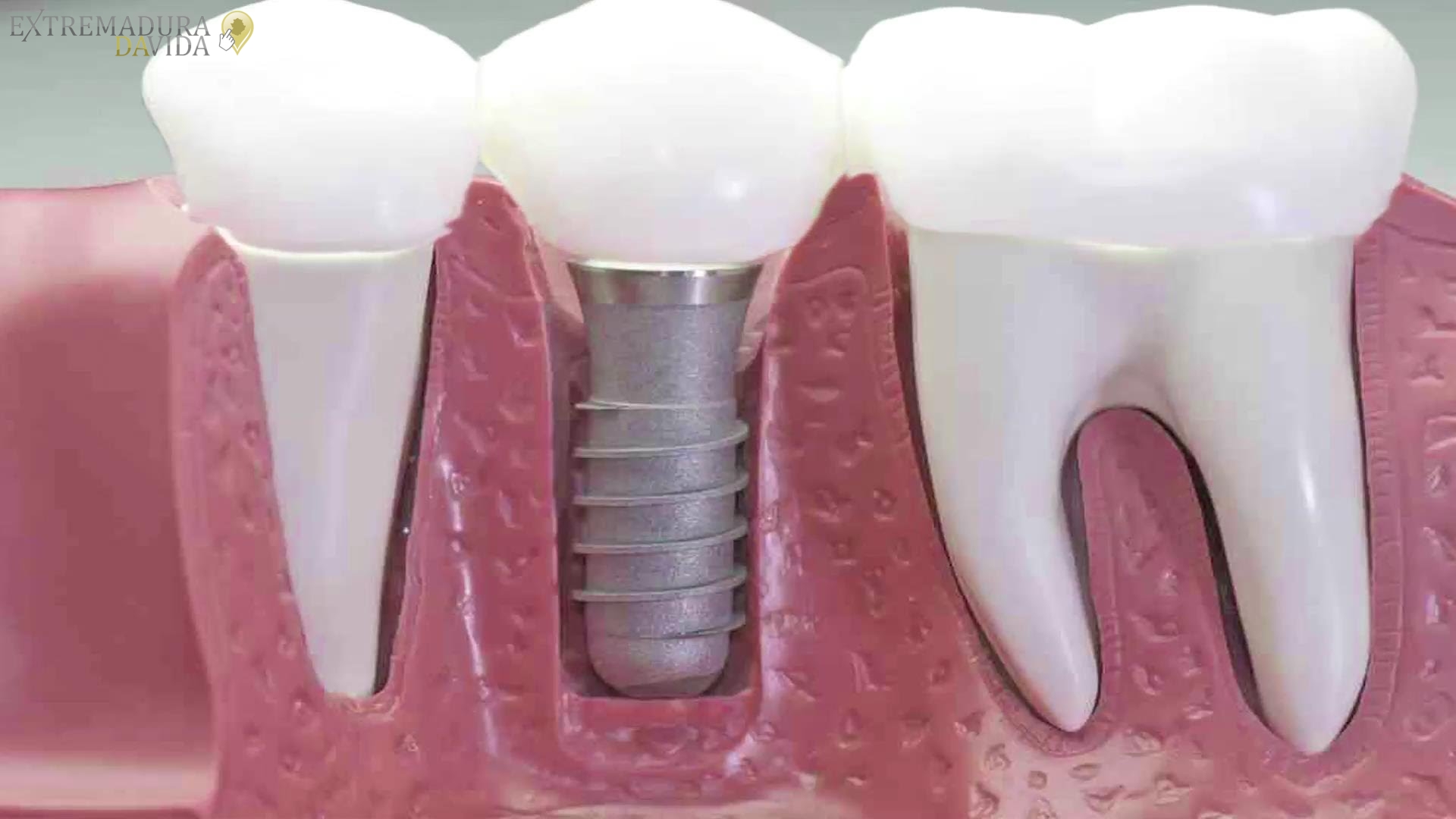 Clínica Dental Cáceres Dentalife