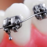 Clínica Dental en Cáceres VERY DENT`S