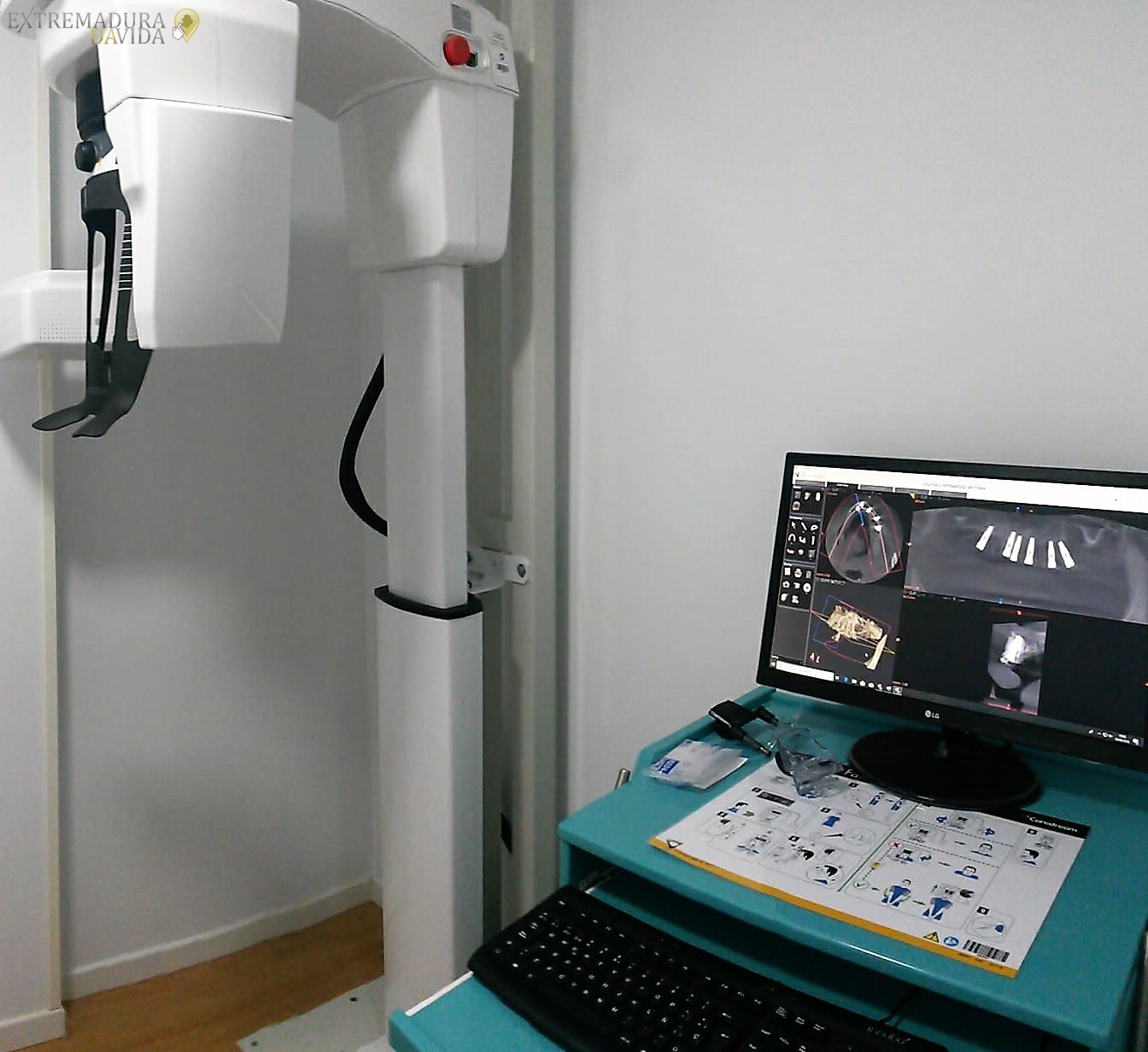 Clinica dental en Cáceres Dentalife Promoción Ultima Tecnologia Tac 3d 